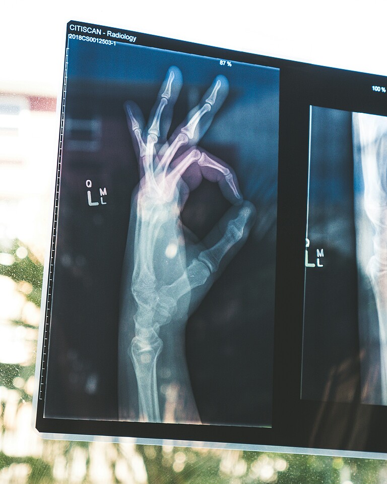 Eine Röntgenaufnahme einer Hand, bei der sich Zeigefinger und Daumen berühren, in der Geste die oft für „sehr gut“ steht. 
